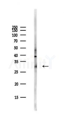 Calretinin Antibody - Western blot analysis of lysates from PC12 cells(starvation,24h treatment), using Calretinin Antibody at 1/1000 dilution.