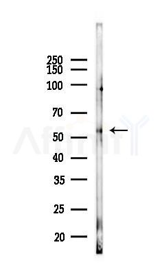 Vitamin D Binding protein Antibody - Western blot analysis of lysates from A375 cells(heat-shock,45min treatment), using Vitamin D Binding protein Antibody at 1/1000 dilution.