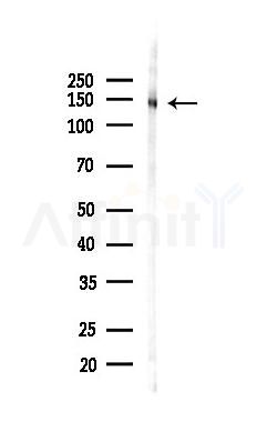 SYNGAP1 Antibody - Western blot analysis of lysates from Rat brain, using SYNGAP1 Antibody at 1/1000 dilution.