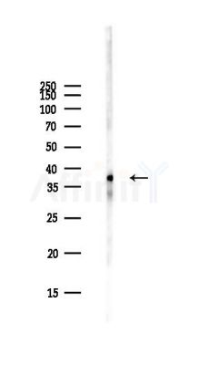 TRIB3 Antibody - Western blot analysis of lysates from PC12 cells(starvation,24h treatment), using TRIB3 Antibody at 1/1000 dilution.