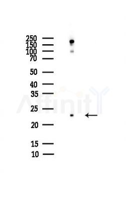 AGR2 Antibody - Western blot analysis of lysates from HepG2 cells(heat-shock,45min treatment), using AGR2 Antibody at 1/1000 dilution.