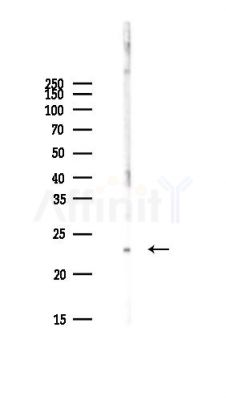 AGR2 Antibody - Western blot analysis of lysates from PC12 cells(starvation,24h treatment), using AGR2 Antibody at 1/1000 dilution.