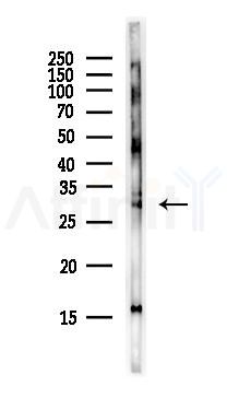 HHEX Antibody - Western blot analysis of lysates from Rat lung, using HHEX Antibody at 1/1000 dilution.