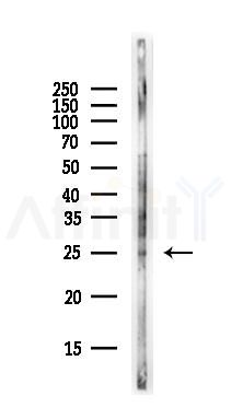 GSTK1 Antibody - Western blot analysis of lysates from Rat lung, using GSTK1 Antibody at 1/1000 dilution.