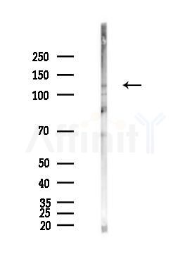 PUM1 Antibody - Western blot analysis of lysates from Hela cells(heat-shock,45min treatment), using PUM1 Antibody at 1/1000 dilution.