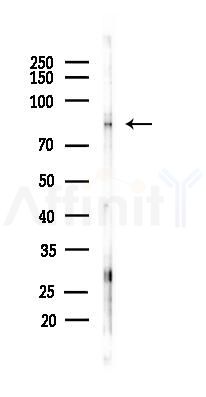SATB1 Antibody - Western blot analysis of lysates from PC12 cells(uv30min treatment), using SATB1 Antibody at 1/1000 dilution.