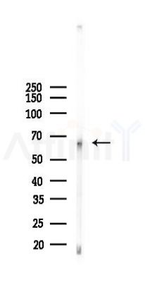 MSLN Antibody - Western blot analysis of lysates from HepG2 cells(starvation, 24h treatment), using MSLN Antibody at 1/1000 dilution.