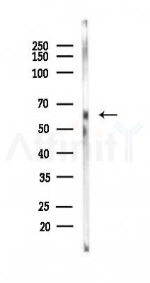 MSLN Antibody - Western blot analysis of lysates from PC12 cells(uv30min treatment), using MSLN Antibody at 1/1000 dilution.