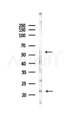 ATG12 Antibody - Western blot analysis of lysates from Rat liver, using ATG12 Antibody at 1/1000 dilution.