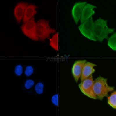 FDX1 Antibody - DF7950 staining Hela cells(30min of UV treatment) by IF/ICC.