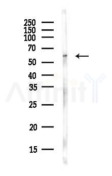 ORAI1 Antibody - Western blot analysis of lysates from MCF7 cells(heat-shock,45min treatment), using ORAI1 Antibody at 1/1000 dilution.