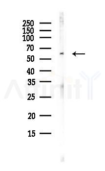 ORAI1 Antibody - Western blot analysis of lysates from PC12 cells(LPS, 4h treatment), using ORAI1 Antibody at 1/1000 dilution.