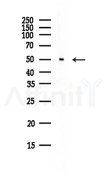 RUVBL1 Antibody - Western blot analysis of lysates from MCF7 cells(heat-shock,45min treatment), using RUVBL1 Antibody at 1/1000 dilution.