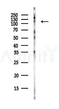 TRPM8 Antibody - Western blot analysis of lysates from MCF7 cells(heat-shock,45min treatment), using TRPM8 Antibody at 1/1000 dilution.