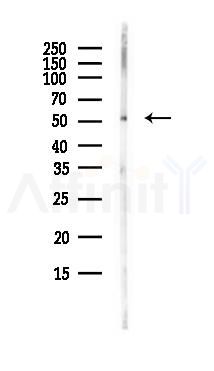 RGS9 Antibody - Western blot analysis of lysates from PC12 cells(LPS, 4h treatment), using RGS9 Antibody at 1/1000 dilution.