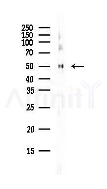 TUBA1B Antibody - Western blot analysis of lysates from MCF7 cells(heat-shock,45min treatment), using TUBA1B Antibody at 1/1000 dilution.