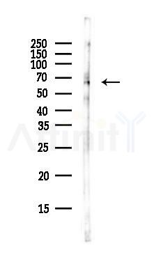 GRN Antibody - Western blot analysis of lysates from Rat lung, using GRN Antibody at 1/1000 dilution.