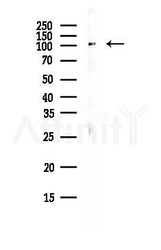 ACTN4 Antibody - Western blot analysis of lysates from MCF7 cells(heat-shock,45min treatment), using ACTN4 Antibody at 1/1000 dilution.