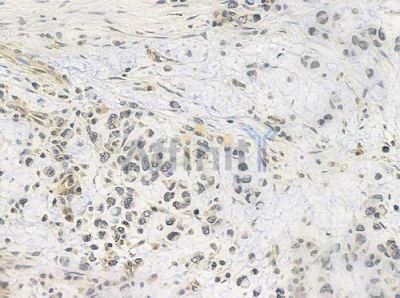 FLII Antibody - DF8003 at 1/100 staining human normal gastric tissue by IHC-P.