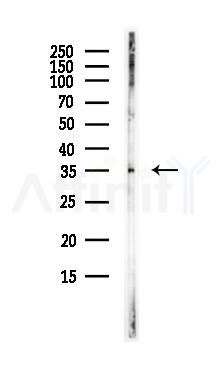 SMN1 Antibody - Western blot analysis of lysates from PC12 cells(LPS, 4h treatment), using SMN1 Antibody at 1/1000 dilution.