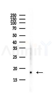 UBE2L3 Antibody - Western blot analysis of lysates from MCF7 cells(heat-shock,45min treatment), using UBE2L3 Antibody at 1/1000 dilution.