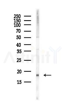 UBE2L3 Antibody - Western blot analysis of lysates from PC12 cells(LPS, 4h treatment), using UBE2L3 Antibody at 1/1000 dilution.