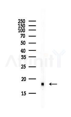UBE2L3 Antibody - Western blot analysis of lysates from Rat lung, using UBE2L3 Antibody at 1/1000 dilution.