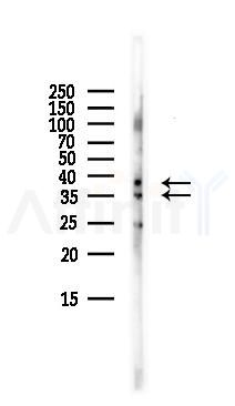 UNG Antibody - Western blot analysis of lysates from Mouse brain, using UNG Antibody at 1/1000 dilution.