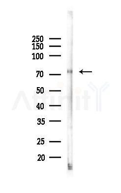 Lactoferrin Antibody - Western blot analysis of lysates from Rat liver, using Lactoferrin Antibody at 1/1000 dilution.