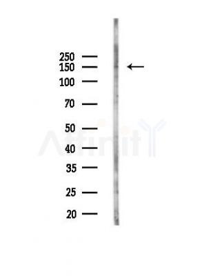 MYBPC3 Antibody - Western blot analysis of lysates from Hela cells(UV,30min treatment), using MYBPC3 Antibody at 1/1000 dilution.