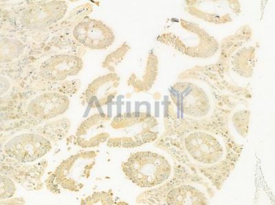 Galectin 1 Antibody - DF8089 at 1/100 staining human normal colon tissue by IHC-P.