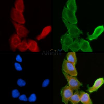 Galectin 1 Antibody - DF8089 staining Hela cells(30min of UV treatment) by IF/ICC.