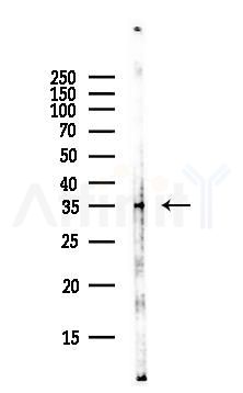 Thymidylate Synthase Antibody - Western blot analysis of lysates from Rat lung, using Thymidylate Synthase Antibody at 1/1000 dilution.