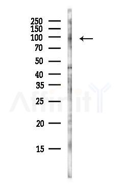 PLK4 Antibody - Western blot analysis of lysates from HepG2 cells(heat-shock, 45min treatment), using PLK4 Antibody at 1/1000 dilution.