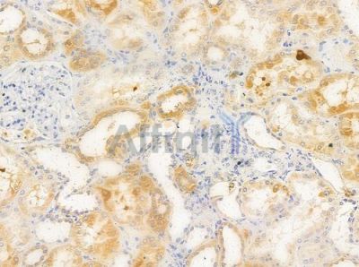 FNTA Antibody - DF8125 at 1/100 staining human normal kidney tissue by IHC-P.