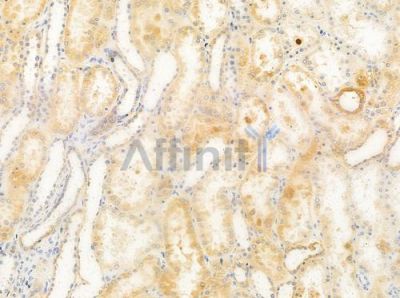 FNTA Antibody - DF8125 at 1/100 staining human normal kidney tissue by IHC-P.