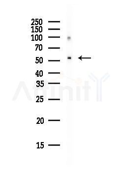 PNPLA2 Antibody - Western blot analysis of lysates from HepG2 cells(heat-shock, 45min treatment), using PNPLA2 Antibody at 1/1000 dilution.