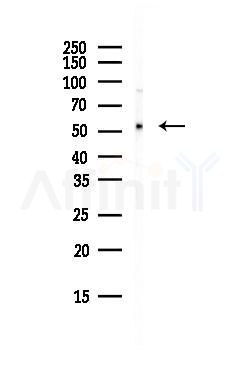 PNPLA2 Antibody - Western blot analysis of lysates from HepG2 cells(starvation, 24h treatment), using PNPLA2 Antibody at 1/1000 dilution.