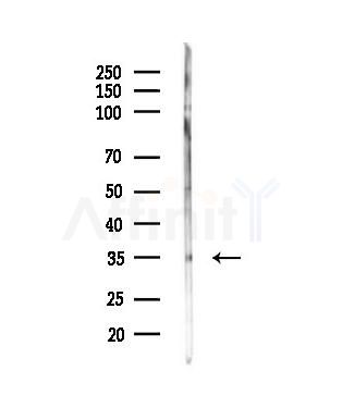 BNIP3L Antibody - Western blot analysis of lysates from MCF7 cells(heat-shock,45min treatment), using BNIP3L Antibody at 1/1000 dilution.
