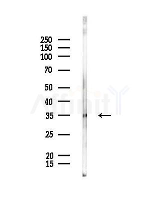 BNIP3L Antibody - Western blot analysis of lysates from PC12 cells, using BNIP3L Antibody at 1/1000 dilution.