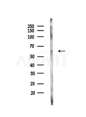 PRKAA2 Antibody - Western blot analysis of lysates from Hela cells(UV,30min treatment), using PRKAA2 Antibody at 1/1000 dilution.