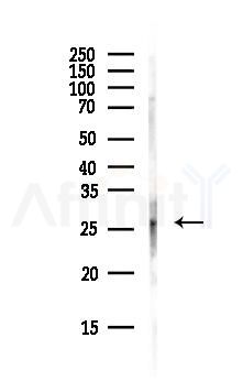 BNIP3 Antibody - Western blot analysis of lysates from Mouse brain, using BNIP3 Antibody at 1/1000 dilution.