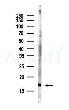 UBE2N Antibody - Western blot analysis of lysates from HepG2 cells(starvation, 24h treatment), using UBE2N Antibody at 1/1000 dilution.