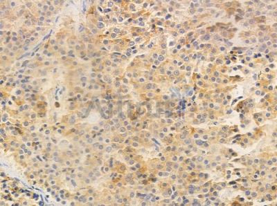 CHRNA4 Antibody - DF8199 at 1/100 staining human pituitary adenoma by IHC-P.