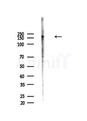 Scribble Antibody - Western blot analysis of lysates from Hela cells(heat-shock,45min treatment), using Scribble Antibody at 1/1000 dilution.
