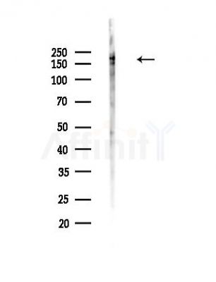 Scribble Antibody - Western blot analysis of lysates from Mouse lung, using Scribble Antibody at 1/1000 dilution.