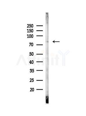 GFPT1 Antibody - Western blot analysis of lysates from Hela cells(UV, 30min treatment), using GFPT1 Antibody at 1/1000 dilution.