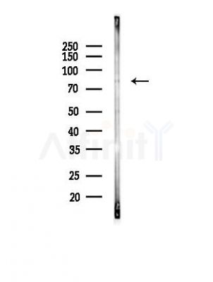 GFPT1 Antibody - Western blot analysis of lysates from HepG2 cells(starvation,24h treatment), using GFPT1 Antibody at 1/1000 dilution.