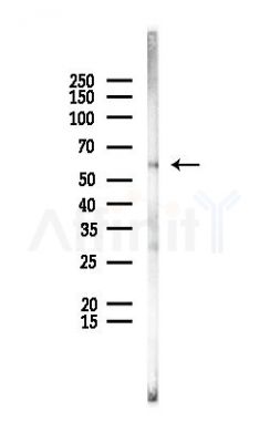 GBA Antibody - Western blot analysis of lysates from Rat liver, using GBA Antibody at 1/1000 dilution.