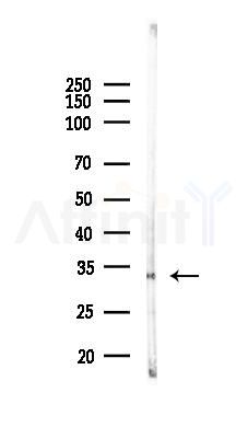 ING2 Antibody - Western blot analysis of lysates from Rat liver, using ING2 Antibody at 1/1000 dilution.